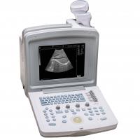 WED-180 All-digital Ultrasound Diagnostic System