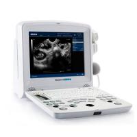 Portable ultrasound with doppler- DUS60