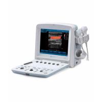 Portable ultrasound scanner with color doppler-U50