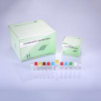 Hepatitis B Virus (HBV) PCR Kit