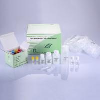 Human Immunodeficiency Virus Type 1 (HIV-1) PCR Kit
