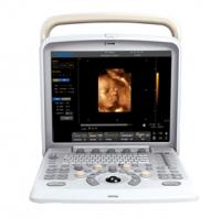 Q5 Best-in-class Compact,Multi-Purpose Ultrasound
