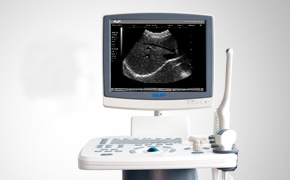 Emp-2900plus - black & white ultrasound system
