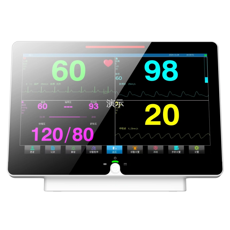 RNpet S15 Veterinary Patient Monitor – ECG, SpO₂, NIBP, Temp & EtCO₂_5