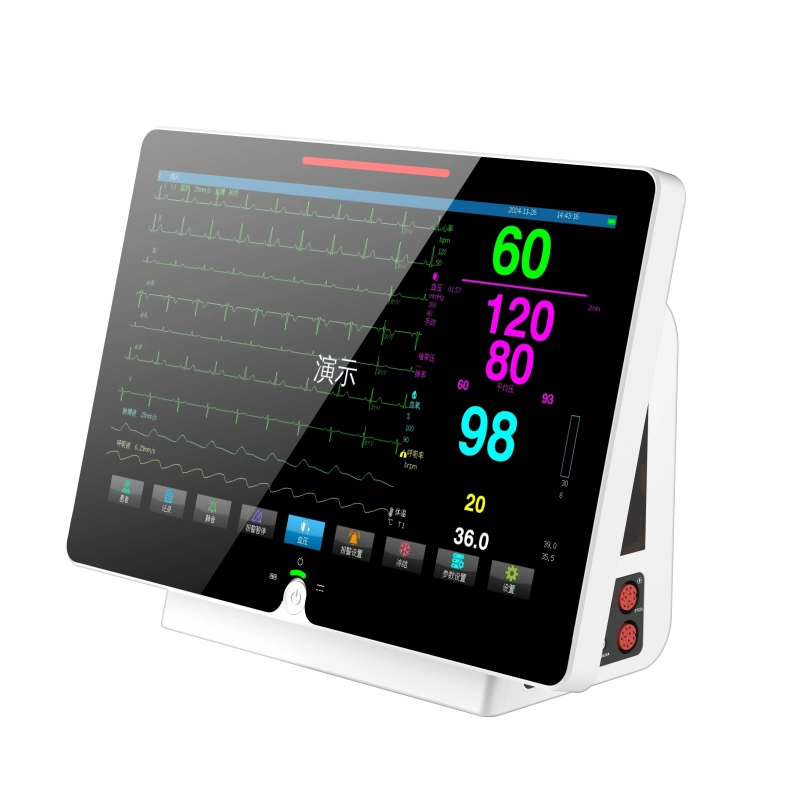RNpet S15 Veterinary Patient Monitor – ECG, SpO₂, NIBP, Temp & EtCO₂_4