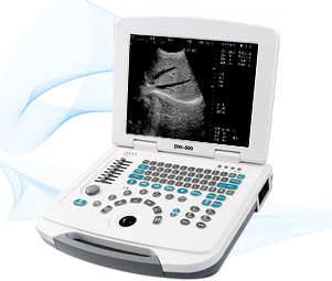 Dw-500 12.1 inch led full-digital laptop ultrasound scanner