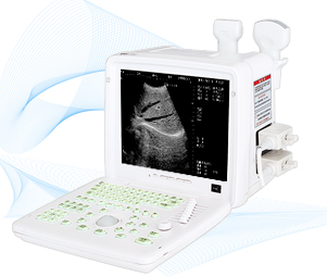 Dw-360 full-digital portable ultrasound scanner