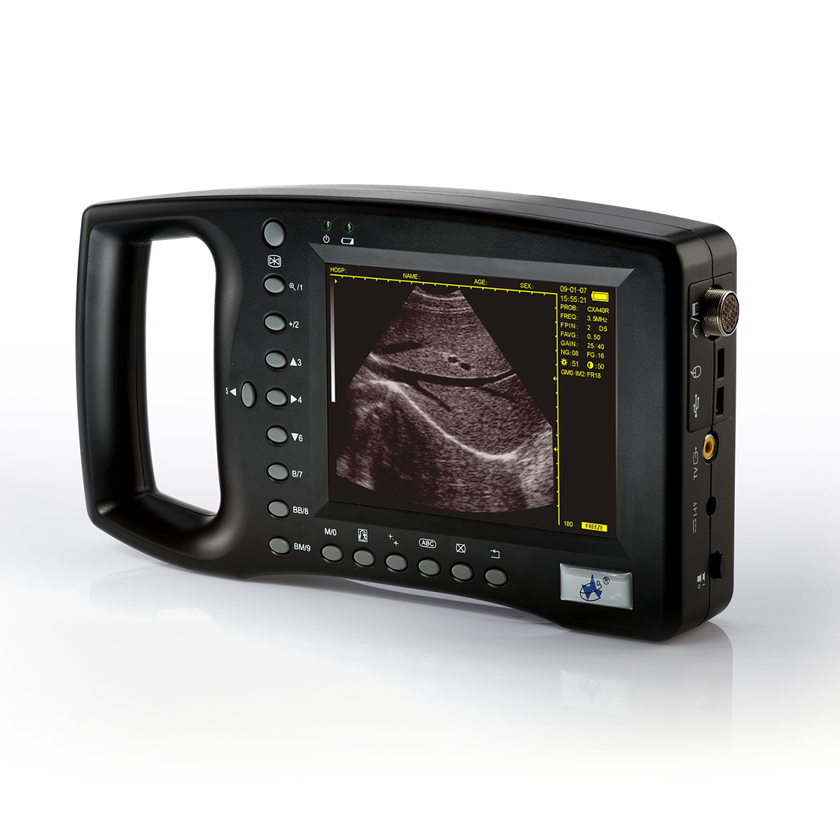 WED-3100 Palm-size Full-digital Ultrasound Diagnostic System