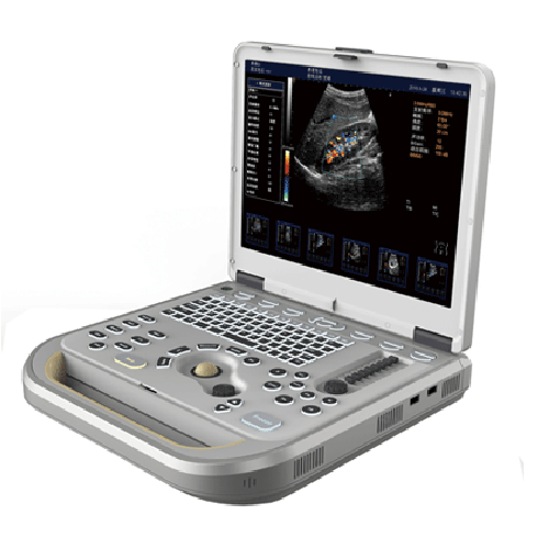 M80 portable color doppler ultrasound diagnostic system